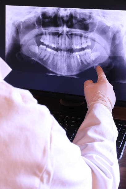 Best Urgent Care for Lost Fillings or Crowns in Santa Barbara, CA