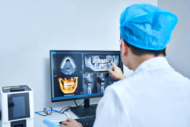 Best Emergency Tooth Extraction in Santa Barbara, CA